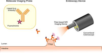 Molecular Endoscopy for the Diagnosis and Therapeutic Monitoring of Colorectal Cancer